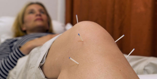 Knee Arthritis Finds Relief with Acupuncture